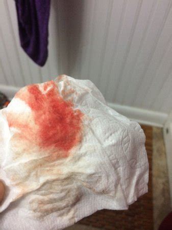 I just got my second period back at the end of February, which was surprisingly right on schedule. . Still bleeding 5 weeks after abortion reddit